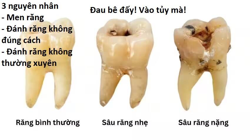 Chương 93 - Trang 65