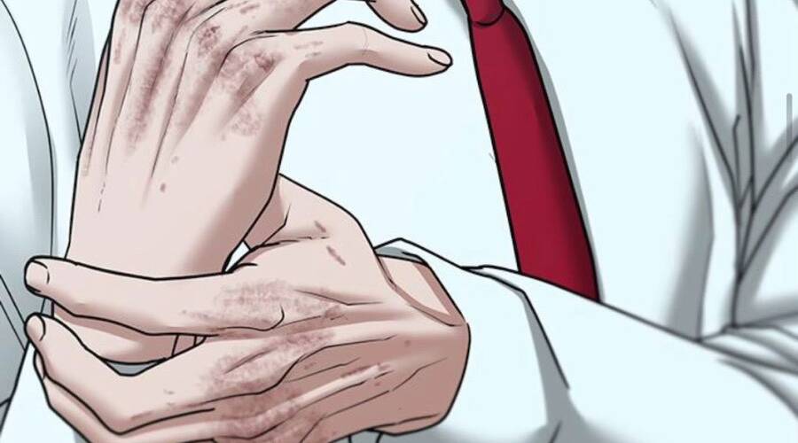 Chapter 33.5 - Trang 76